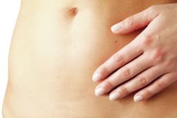 Scar Repair application-Scar Repair application caesarean 2