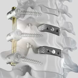 CeSPACE® 3D-Product Picture CW Enlargement