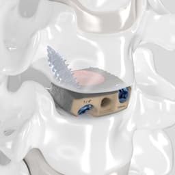 Arcadius XP C®-Product Picture