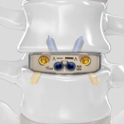 Arcadius XP L®-Product Picture