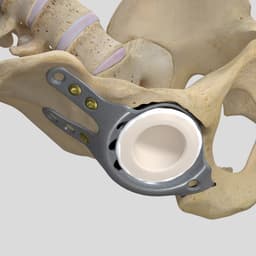 Reconstruction Shell-Product Picture