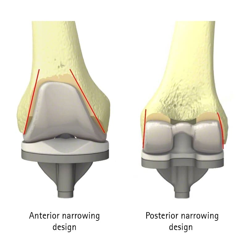 VEGA System®-Product Picture Web Enlargement