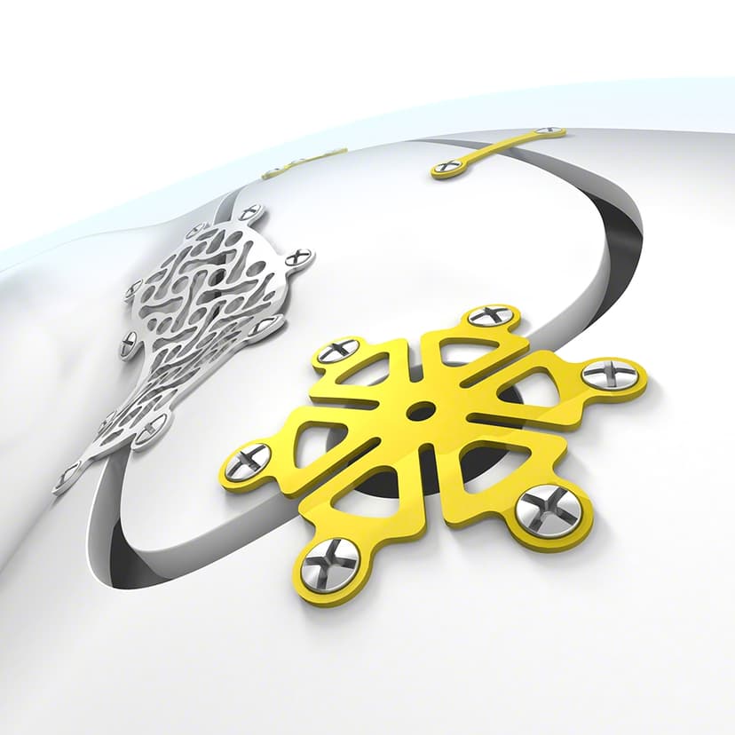 Neuro Plating System-Product Picture Web Enlargement